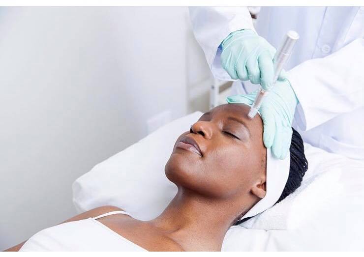 Microneedling Mesoestetic art du soin
